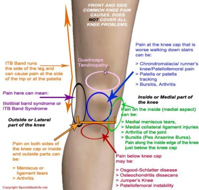 knee pain location chart